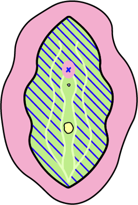 TYP_IV